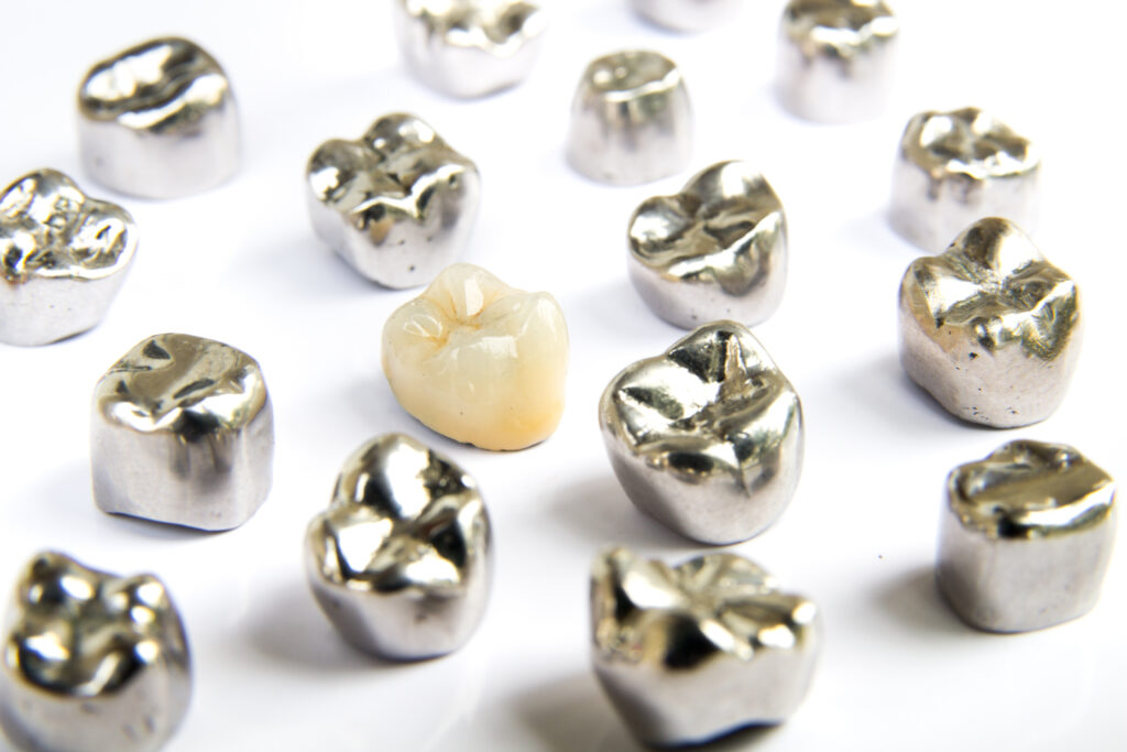 Full Cast Dental Restorations