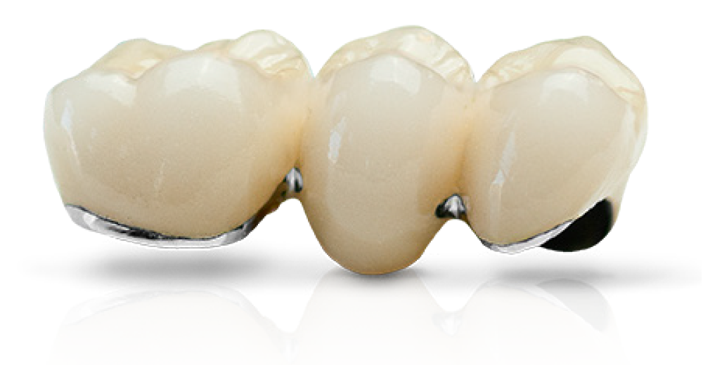 PFM Example Image